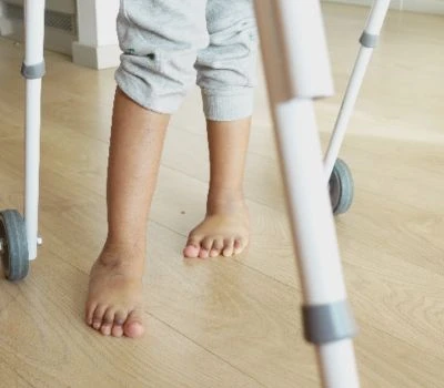 Avvikelse i benlängd: Förstå obalans, känna igen skada och hitta klarhet med 3D-kroppsskanning