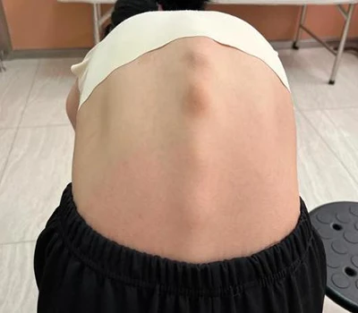 Revolutionerande ryggradshälsa: Xianku 3D Body Scanner
