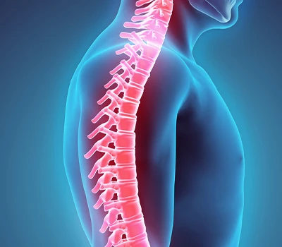 Spinal Correction: Radiation-fri Digital Spine Solution