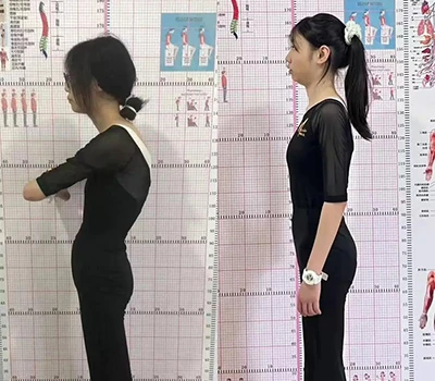 3D Posture Scanning vs. Traditionell bedömning: Varför det blotta ögat missar kritiska frågor